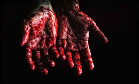 Hands covered with blood